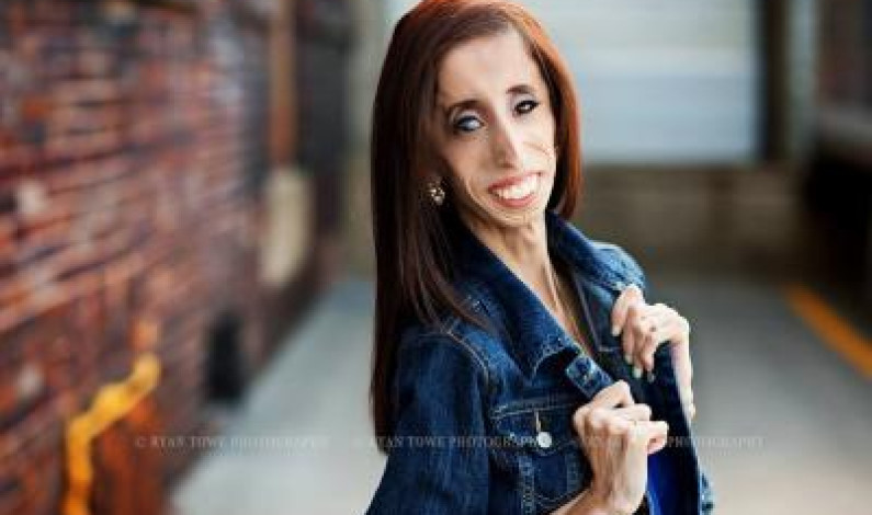 “অক্ষমতা” দমাতে পারেনি কুৎসিত নারীটিকে “অক্ষমতা” দমাতে পারেনি কুৎসিত নারীটিকে