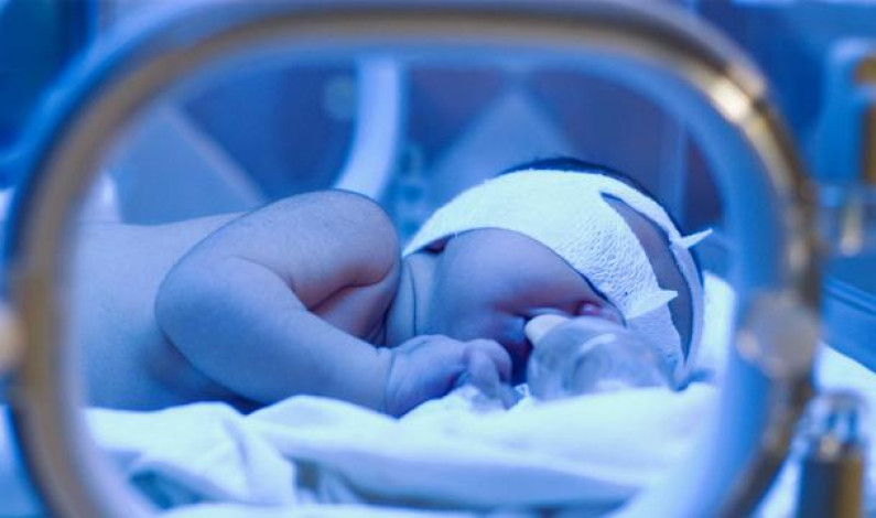 নবজাতকের জন্ডিস হলে করণীয় নবজাতকের জন্ডিস হলে করণীয়