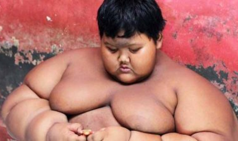 ১০ বছরের বালকের ওজন ১৯২ কেজি ১০ বছরের বালকের ওজন ১৯২ কেজি