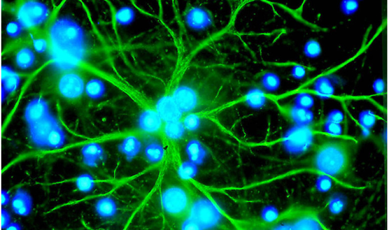 সহজ স্নায়ুবিজ্ঞান বা নিউরনবিজ্ঞান সহজ স্নায়ুবিজ্ঞান বা নিউরনবিজ্ঞান